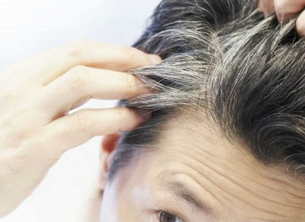 التخلص من الشيب