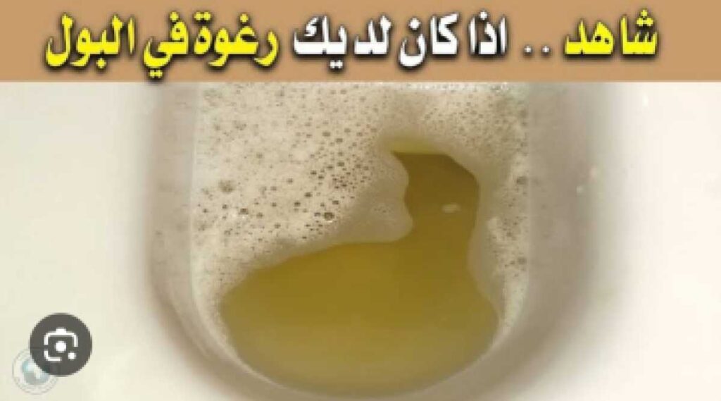 علاج التهاب البول